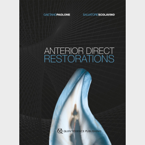 Anterior Direct Restorations