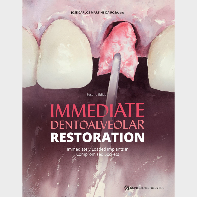 Immediate Dentoalveolar Restoration