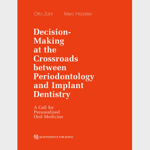 Decision-Making at the Crossroads between Periodontology and Implant Dentistry