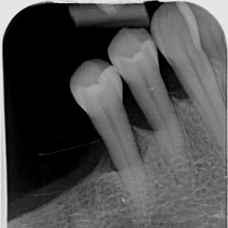 F succes med dine parodontitis-patienter - Modul 1