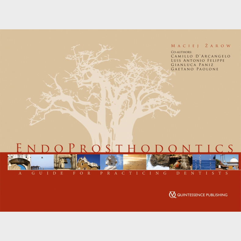 Endoprosthodontics