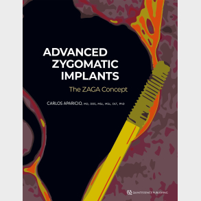 Advanced Zygomatic Implants