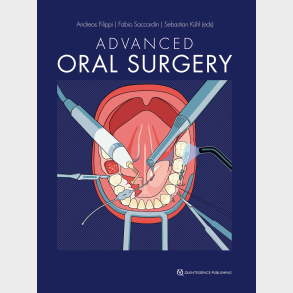 Advanced Oral Surgery