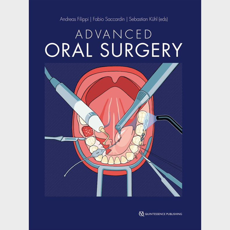 Advanced Oral Surgery