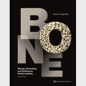 Bone 