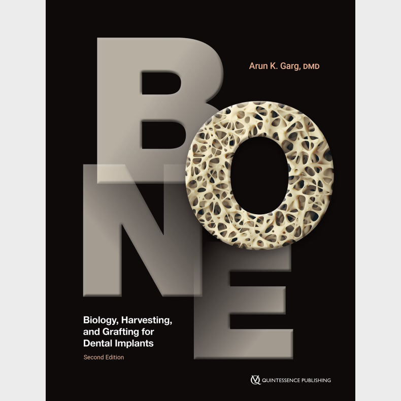 Bone 