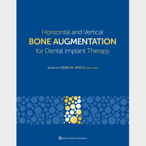 Horizontal and Vertical Bone Augmentation for Dental Implant Therapy