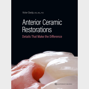Anterior Ceramic Restorations