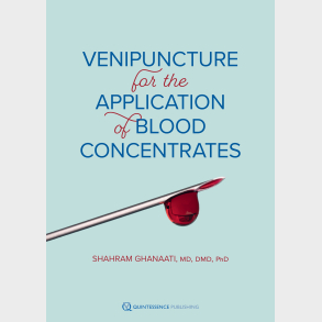 Venipuncture for the Application of Blood Concentrates
