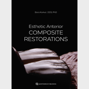 Esthetic Anterior Composite Restorations