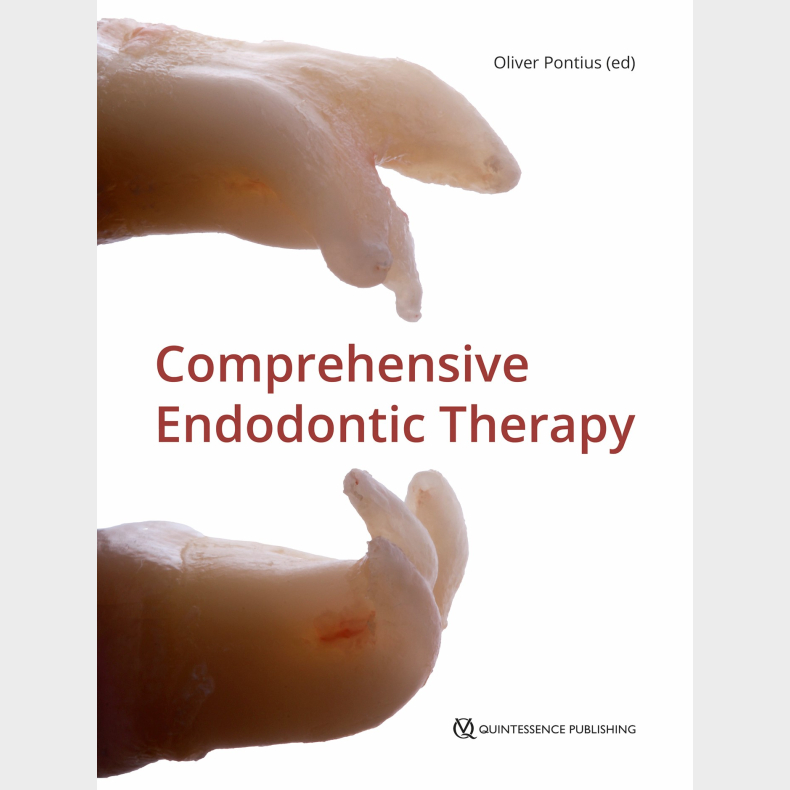 Comprehensive Endodontic Therapy