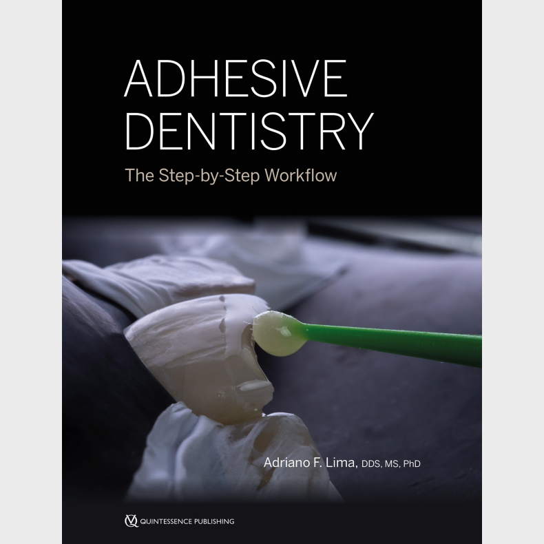 Adhesive Dentistry