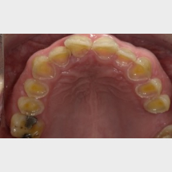 Bidfunktion for hele teamet med Tandl�ge Andrea Poulsen