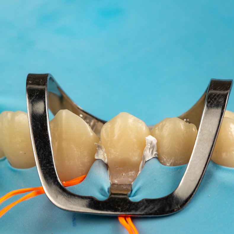 Masterclass - Hands-on Kofferdam