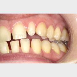 Bidfunktion for hele teamet med Tandl�ge Andrea Poulsen