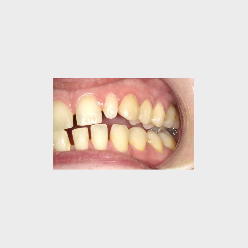 Bidfunktion for hele teamet med Tandl�ge Andrea Poulsen