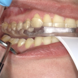 Bidfunktion for hele teamet med Tandl�ge Andrea Poulsen