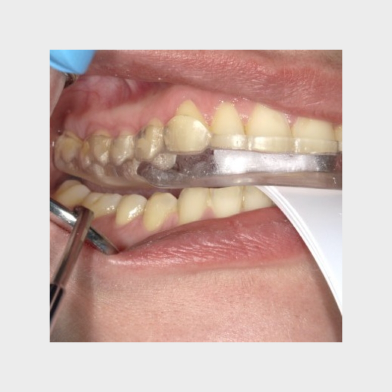 Bidfunktion for hele teamet med Tandl�ge Andrea Poulsen