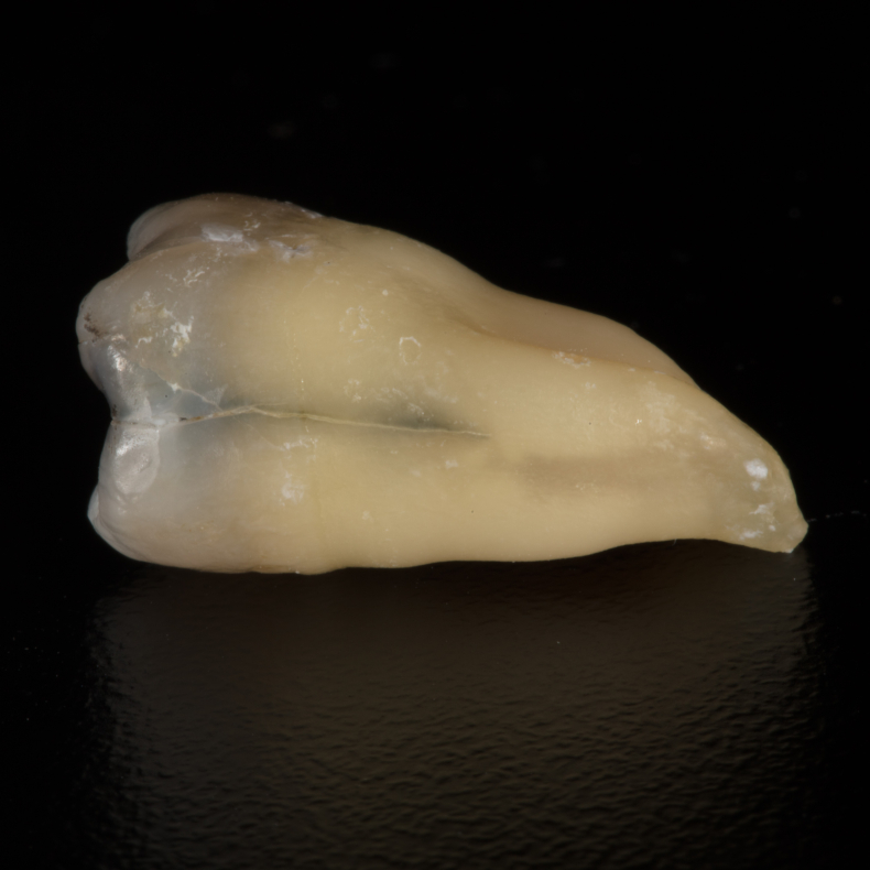 Diagnostik og behandling af infraktioner