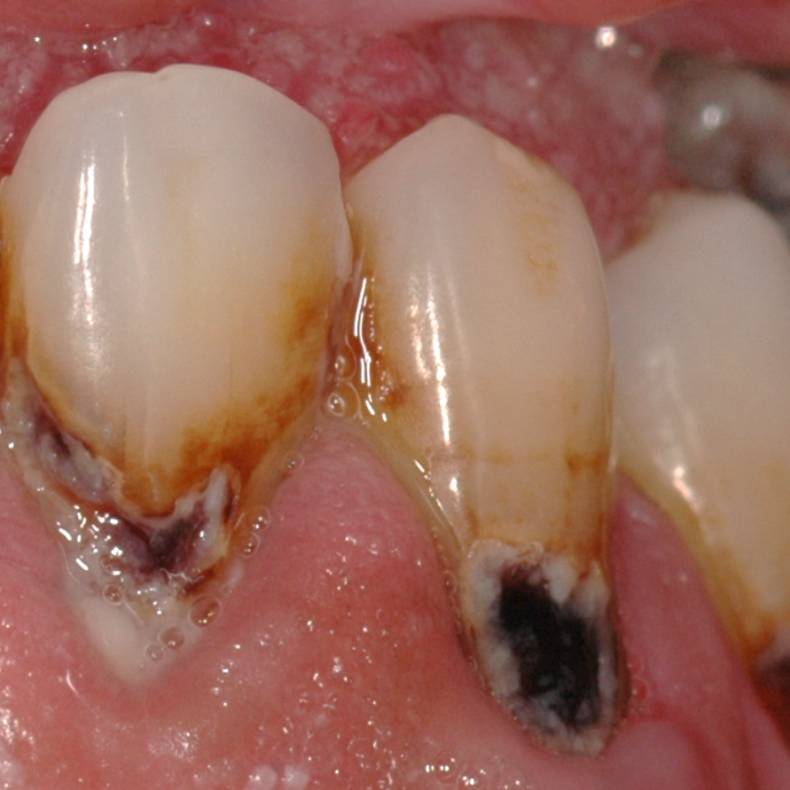 Fra Rod til Resultat