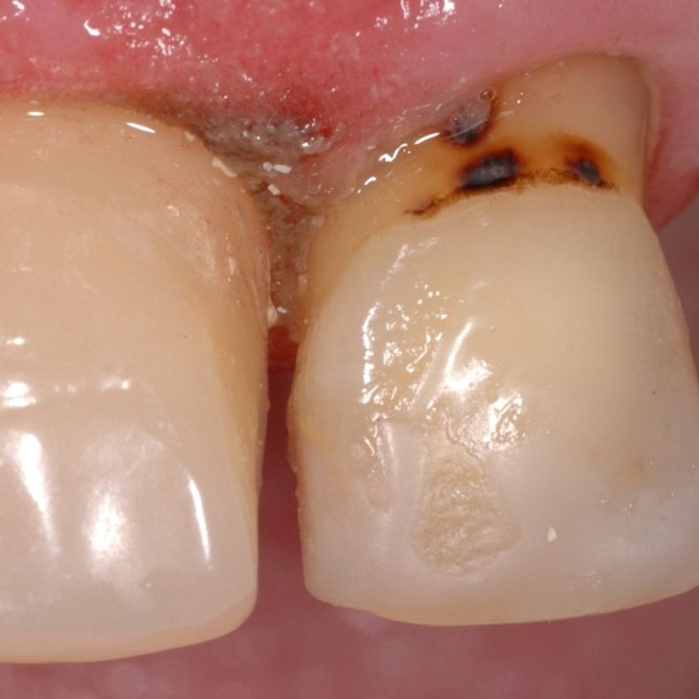 Fra Rod til Resultat