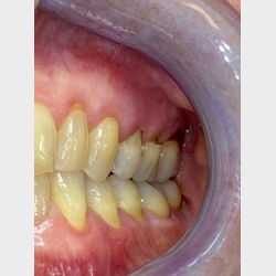 Bidfunktion for hele teamet med Tandl�ge Andrea Poulsen