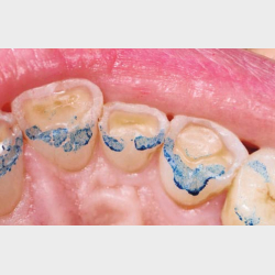 3STEP HANDS-ON med FRANCESCA VAILATI