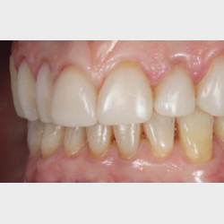 3STEP HANDS-ON med FRANCESCA VAILATI