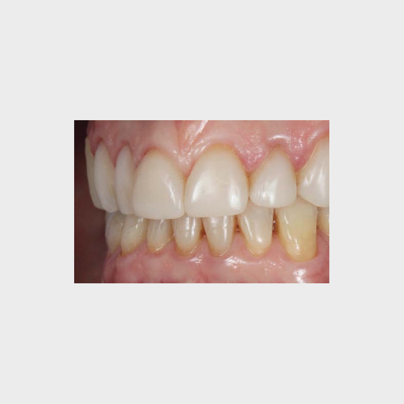 3STEP HANDS-ON med FRANCESCA VAILATI