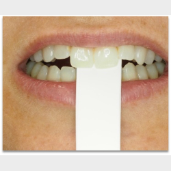 Bidfunktion for hele teamet med Tandl�ge Andrea Poulsen