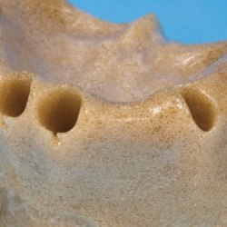 Over- og underkbetrningsmodel 