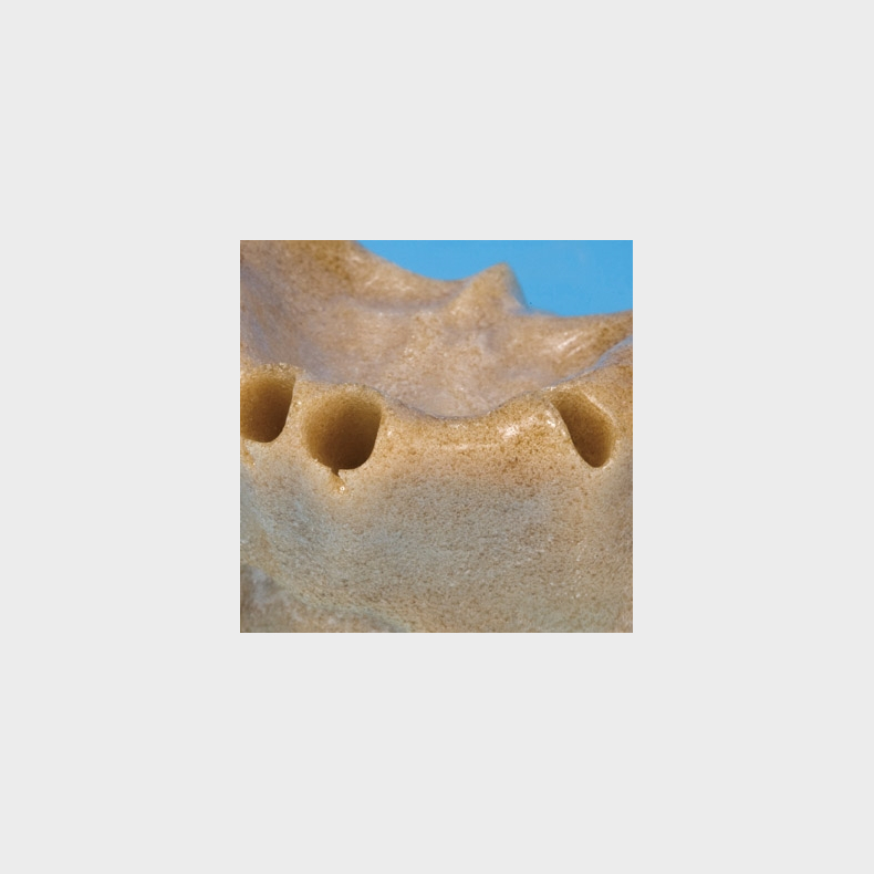 Over- og underkbetrningsmodel 