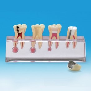 Endodontisk Studiemodel