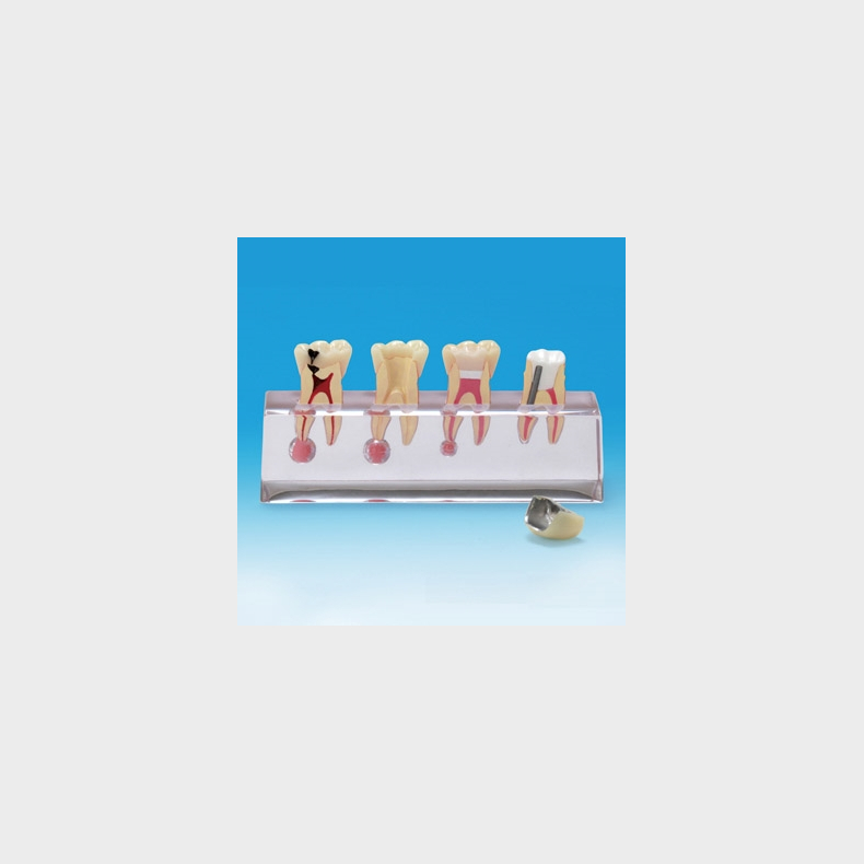 Endodontisk Studiemodel