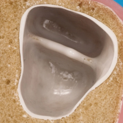 Over- og underkbetrningsmodel 