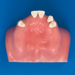 Sinus Life Training Model