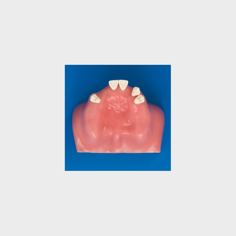 Sinus Life Training Model