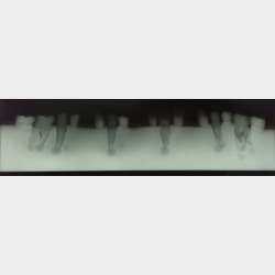 Trningsmodel til rodspidsamputation 