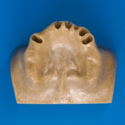 Sinus Life Training Model