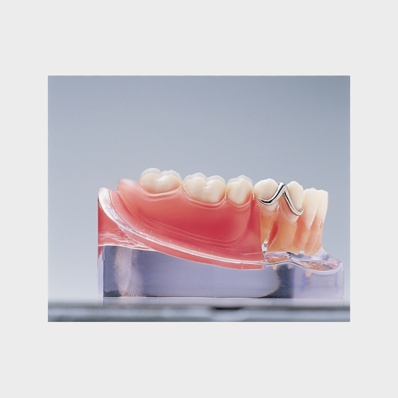 Implantat og delprotese 