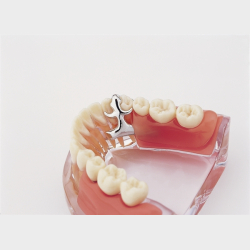 Implantat og delprotese 