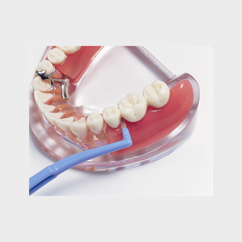 Implantat og delprotese 