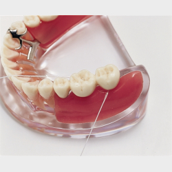 Implantat og delprotese 