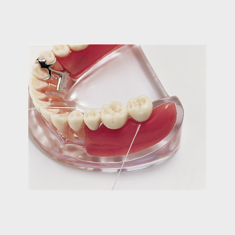 Implantat og delprotese 