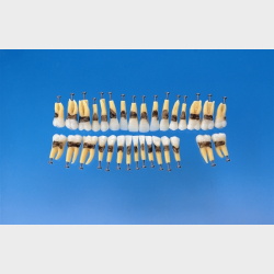 Periodontisk trningsmodel