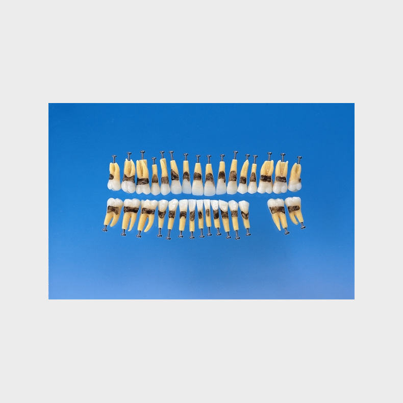 Periodontisk trningsmodel
