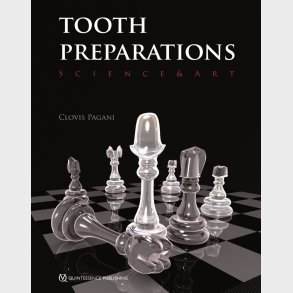 Tooth Preparations