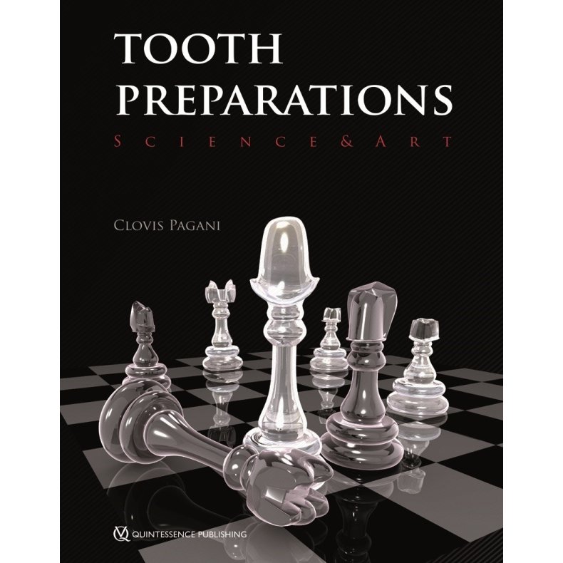 Tooth Preparations