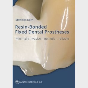 Resin-Bonded Fixed Dental Prostheses