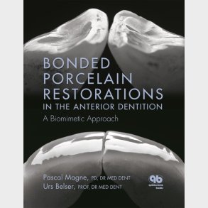 Bonded Porcelain Restorations in the Anterior Dentition